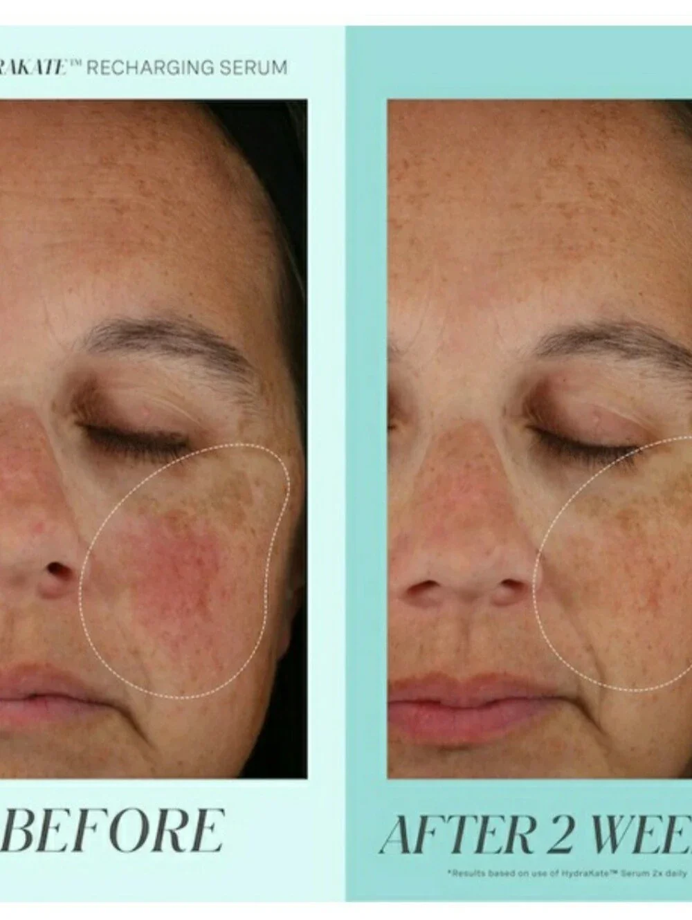 KATE SOMERVILLE HYDRAKATE RECHARGING SERUM